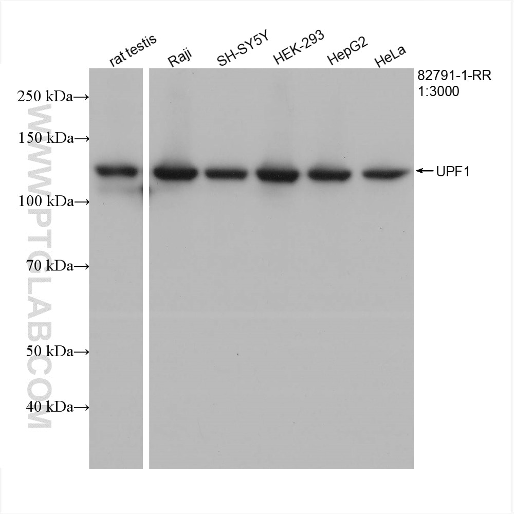 Western Blot (WB) analysis of various lysates using UPF1 Recombinant antibody (82791-1-RR)