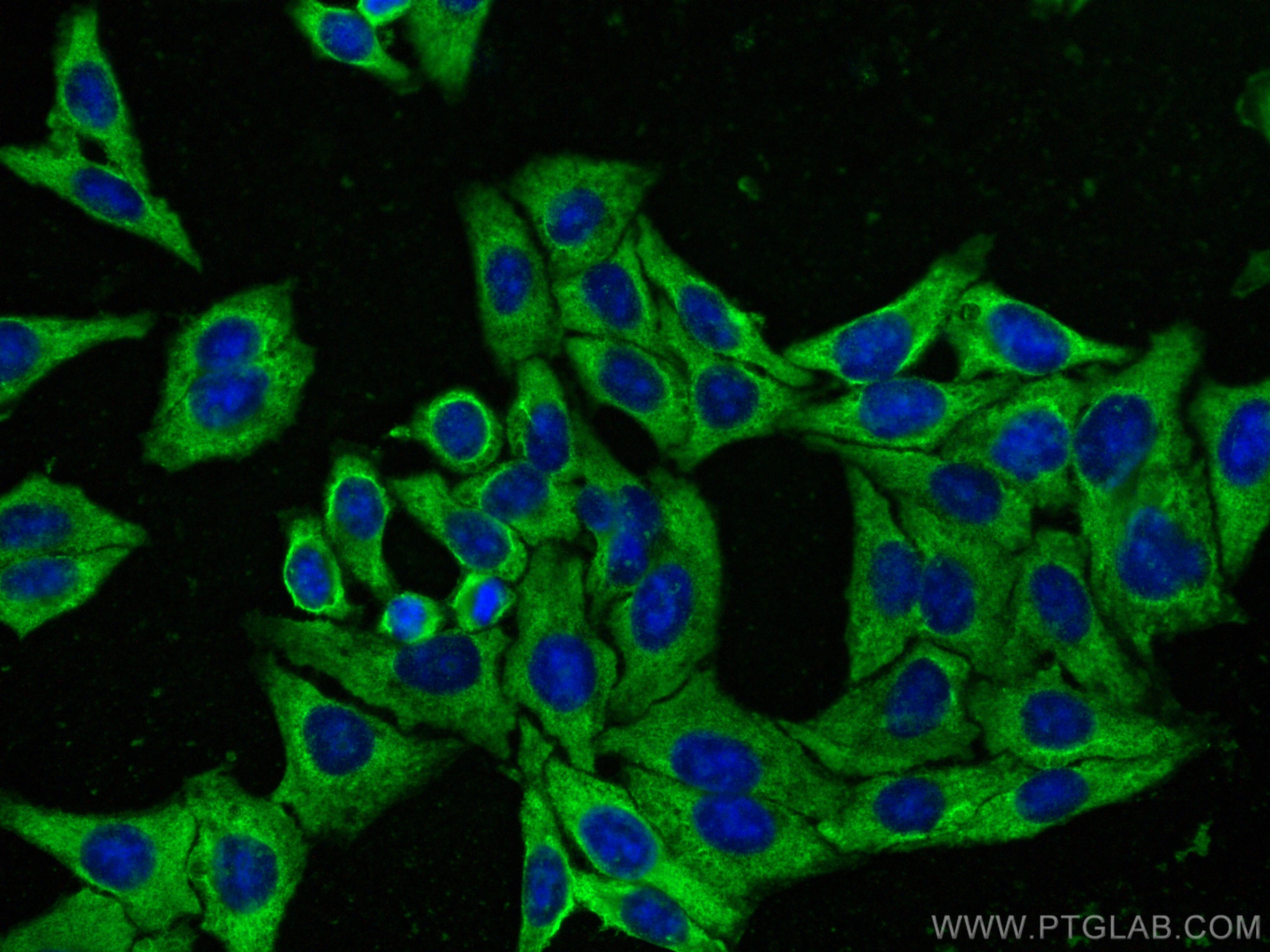 Immunofluorescence (IF) / fluorescent staining of HepG2 cells using CoraLite® Plus 488-conjugated UPF1 Monoclonal anti (CL488-66898)