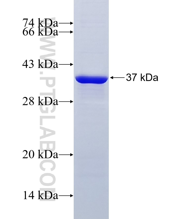 UPF1 fusion protein Ag29057 SDS-PAGE