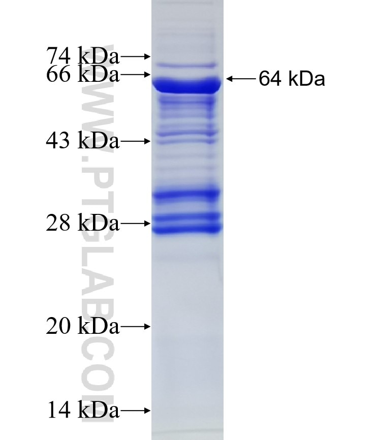 UPF1 fusion protein Ag16195 SDS-PAGE