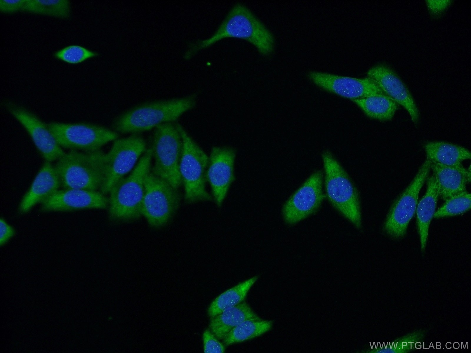 Immunofluorescence (IF) / fluorescent staining of HeLa cells using UPF3A Polyclonal antibody (17114-1-AP)