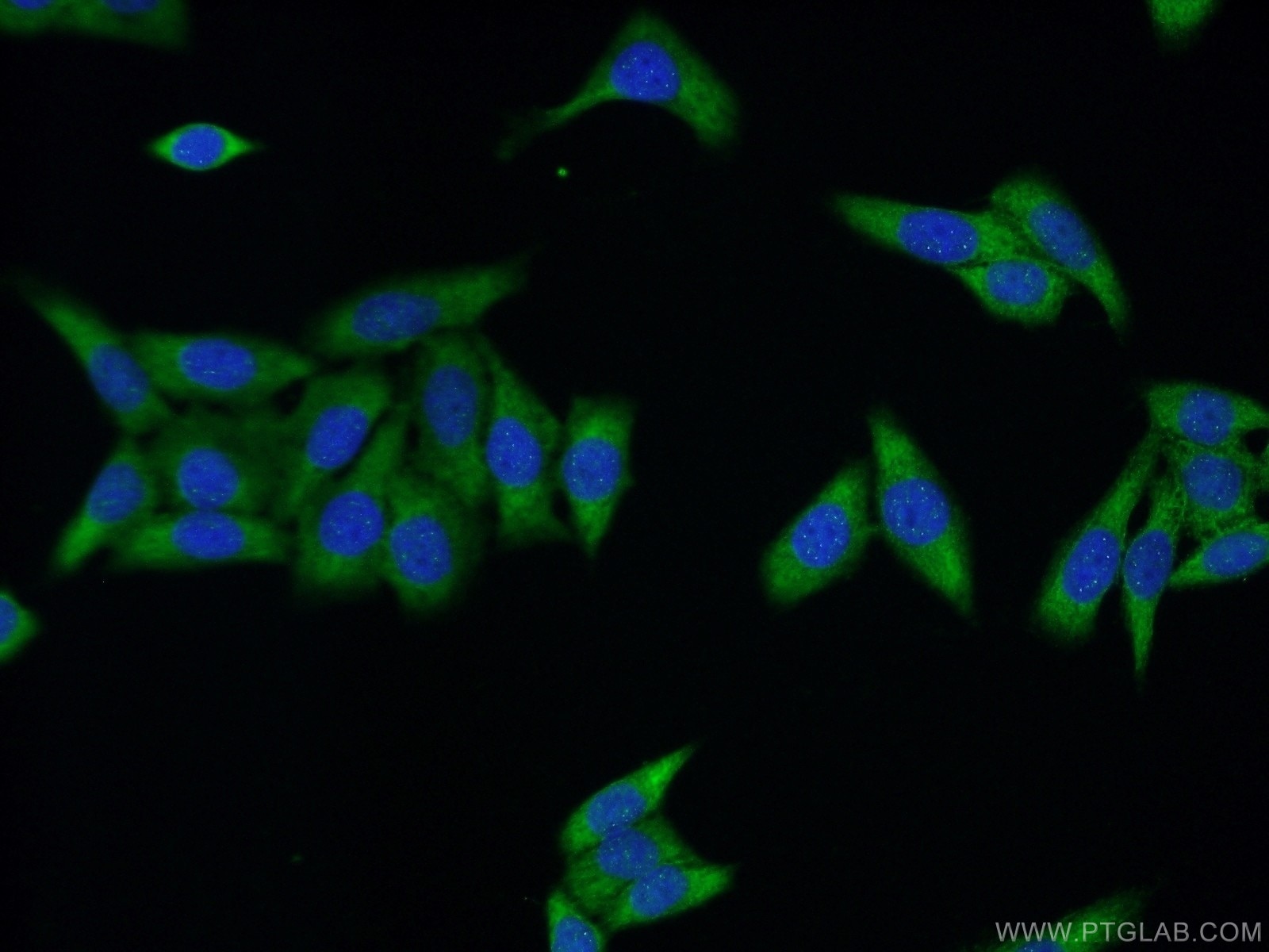 IF Staining of HeLa using 17114-1-AP