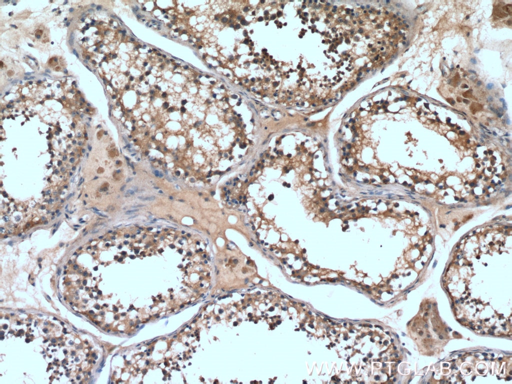 Immunohistochemistry (IHC) staining of human testis tissue using UPF3A Polyclonal antibody (17114-1-AP)