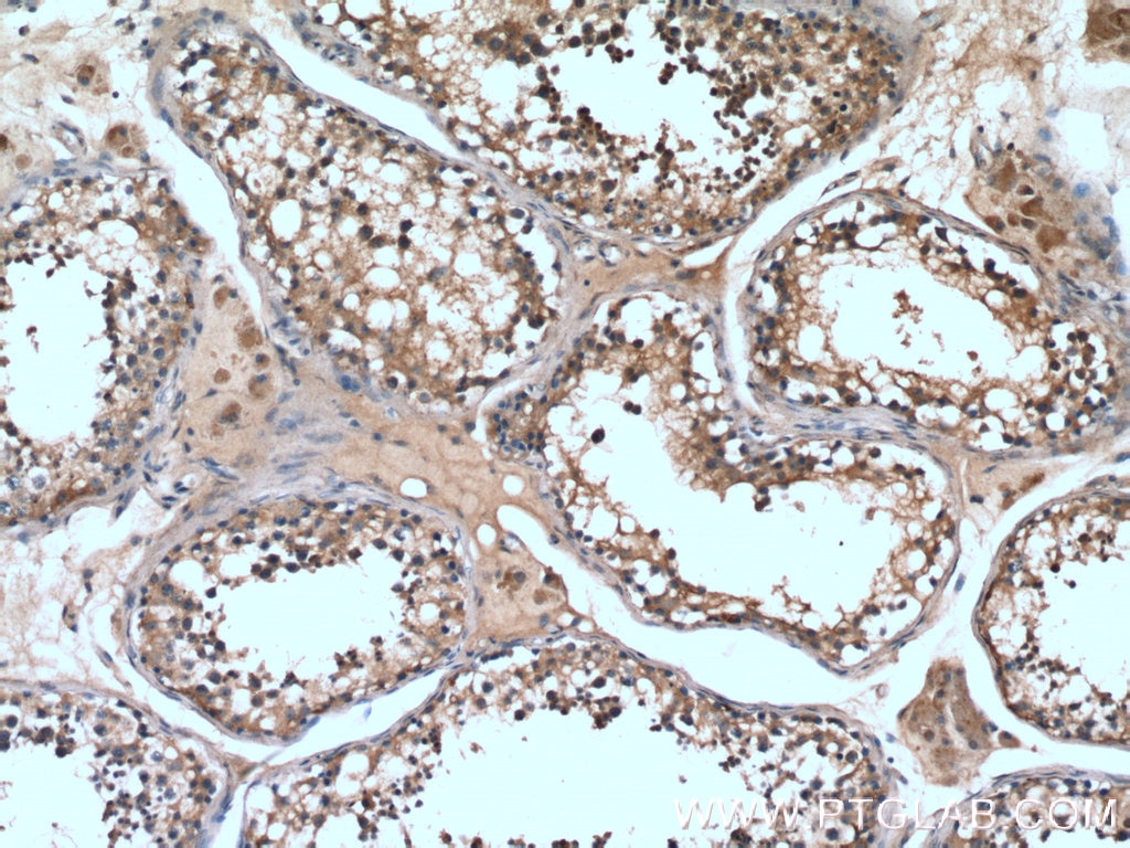 IHC staining of human testis using 17114-1-AP