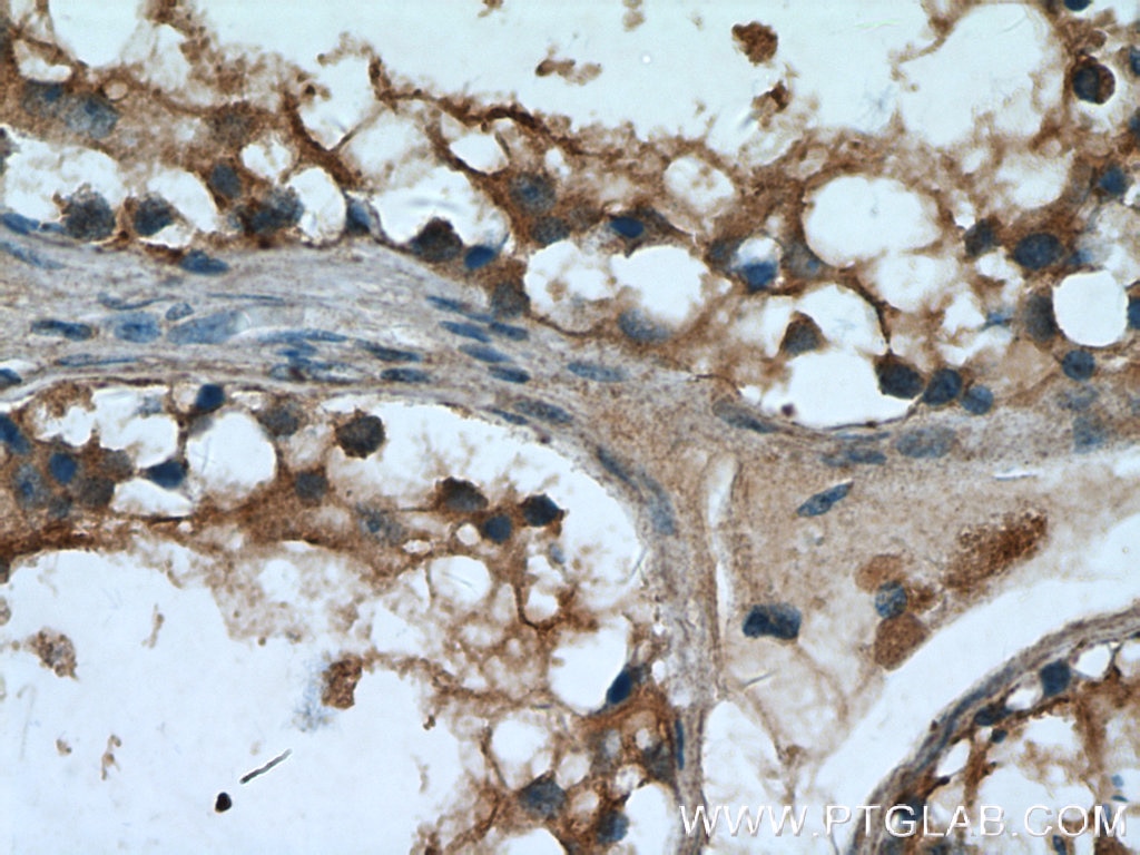 Immunohistochemistry (IHC) staining of human testis tissue using UPF3A Polyclonal antibody (17114-1-AP)