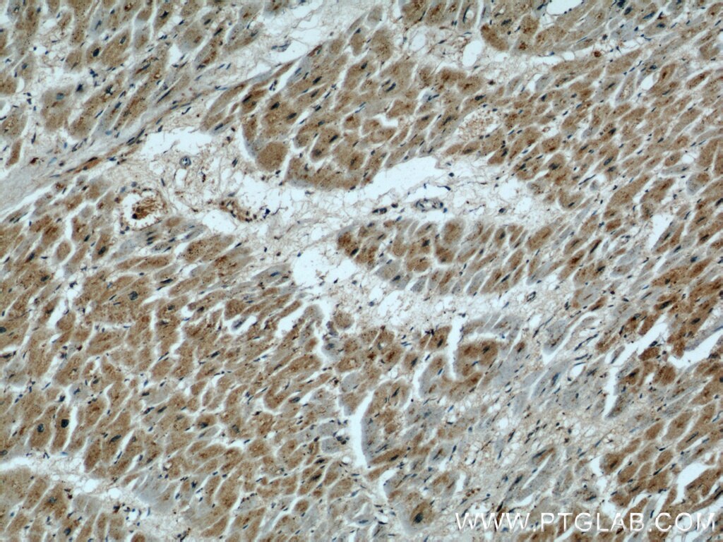 Immunohistochemistry (IHC) staining of human heart tissue using UPF3A Polyclonal antibody (17114-1-AP)