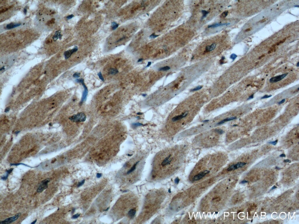 Immunohistochemistry (IHC) staining of human heart tissue using UPF3A Polyclonal antibody (17114-1-AP)