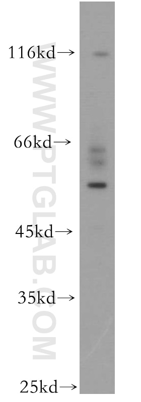 Western Blot (WB) analysis of HeLa cells using UPF3A Polyclonal antibody (17114-1-AP)
