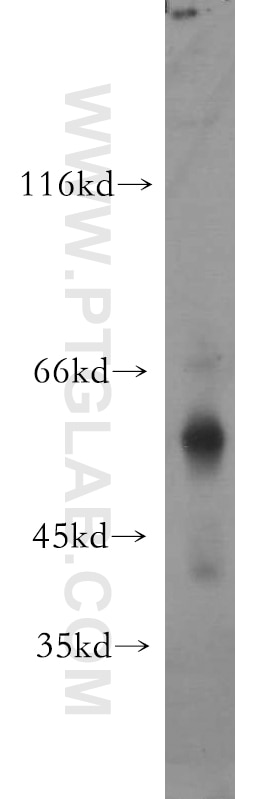 Western Blot (WB) analysis of human testis tissue using UPF3A Polyclonal antibody (17114-1-AP)