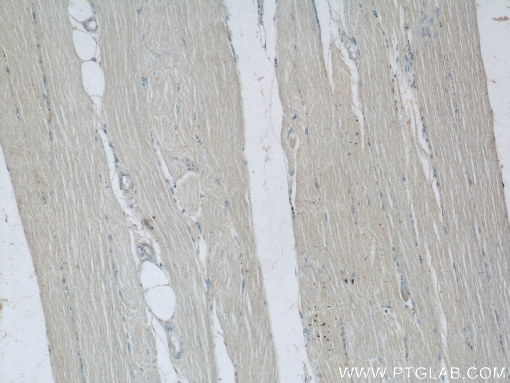 Immunohistochemistry (IHC) staining of human skeletal muscle tissue using UPF3B Polyclonal antibody (23301-1-AP)