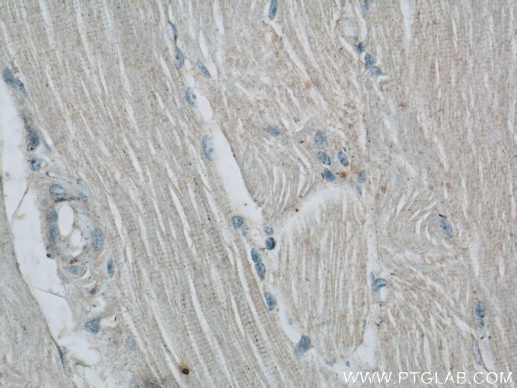 Immunohistochemistry (IHC) staining of human skeletal muscle tissue using UPF3B Polyclonal antibody (23301-1-AP)