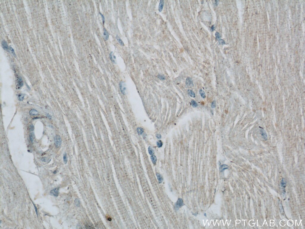 Immunohistochemistry (IHC) staining of human skeletal muscle tissue using UPF3B Polyclonal antibody (23301-1-AP)