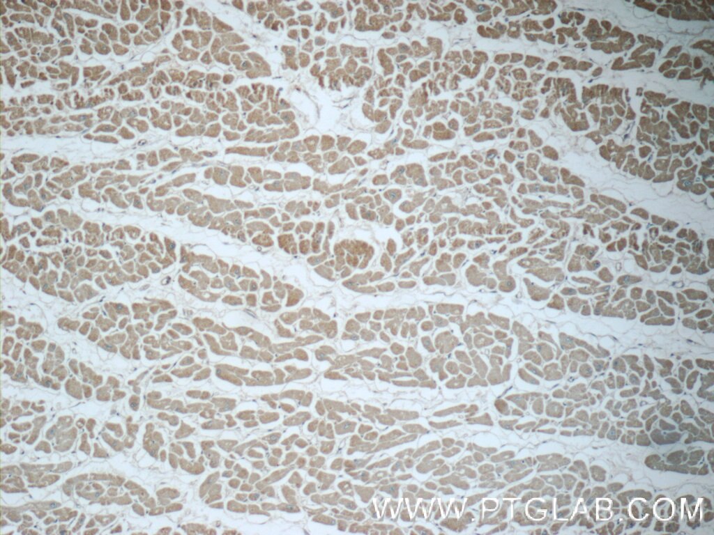 IHC staining of human heart using 23301-1-AP
