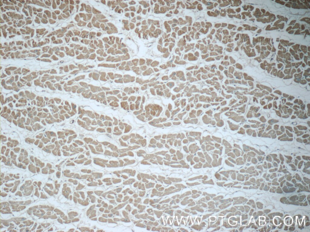 Immunohistochemistry (IHC) staining of human heart tissue using UPF3B Polyclonal antibody (23301-1-AP)