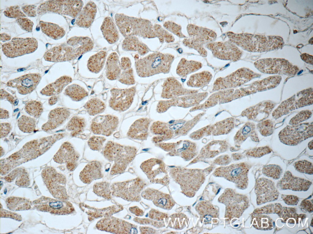 IHC staining of human heart using 23301-1-AP