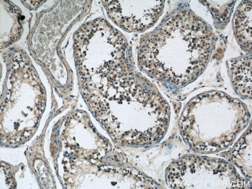 Immunohistochemistry (IHC) staining of human testis tissue using UPF3B Polyclonal antibody (23301-1-AP)