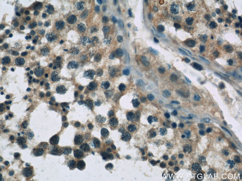 Immunohistochemistry (IHC) staining of human testis tissue using UPF3B Polyclonal antibody (23301-1-AP)