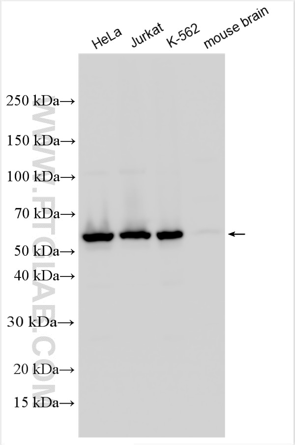 Western Blot (WB) analysis of various lysates using UPF3B Polyclonal antibody (23301-1-AP)