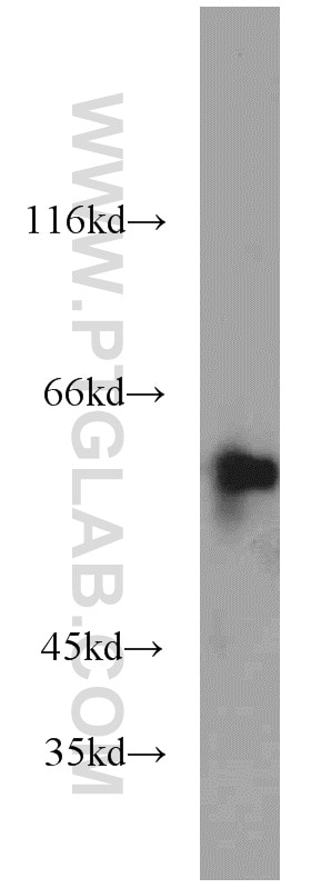Western Blot (WB) analysis of HEK-293 cells using UPF3B Polyclonal antibody (23301-1-AP)