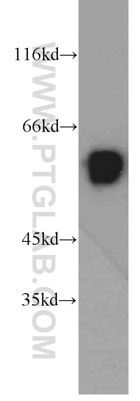 UPF3B Polyclonal antibody