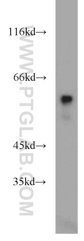 Western Blot (WB) analysis of K-562 cells using UPF3B Polyclonal antibody (23301-1-AP)