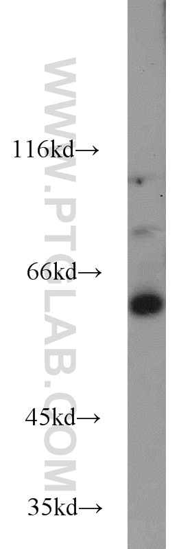 Western Blot (WB) analysis of mouse brain tissue using UPF3B Polyclonal antibody (23301-1-AP)