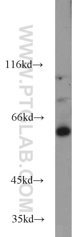 WB analysis of mouse brain using 23301-1-AP