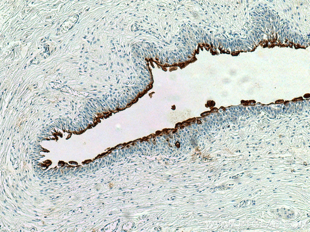 IHC staining of human bladder using 25275-1-AP