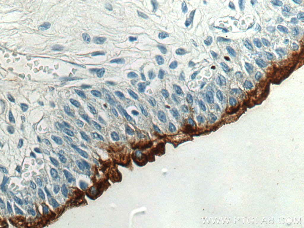 Immunohistochemistry (IHC) staining of human bladder tissue using UPK1A Polyclonal antibody (25275-1-AP)