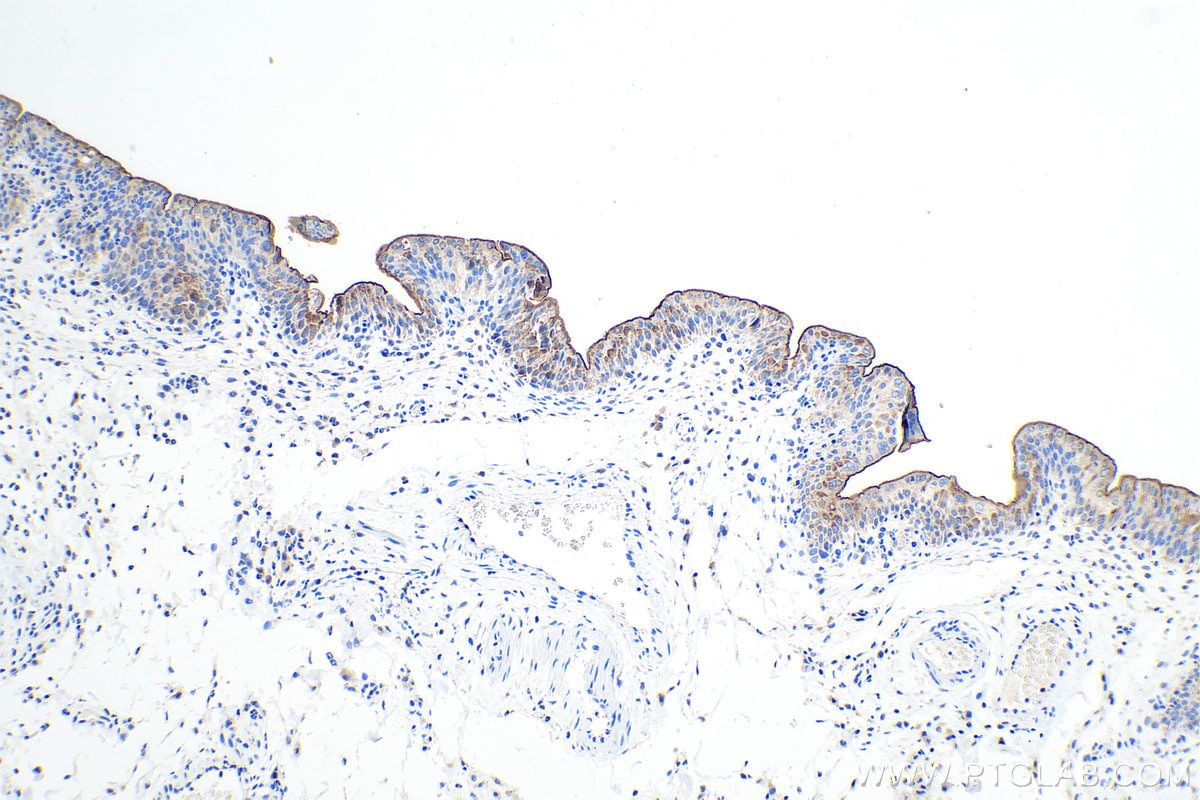 Immunohistochemistry (IHC) staining of rat bladder tissue using UPK1A Polyclonal antibody (25275-1-AP)