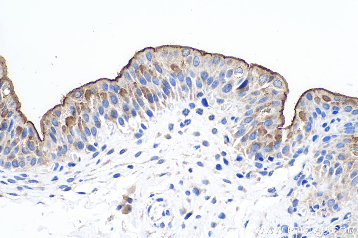 Immunohistochemistry (IHC) staining of rat bladder tissue using UPK1A Polyclonal antibody (25275-1-AP)