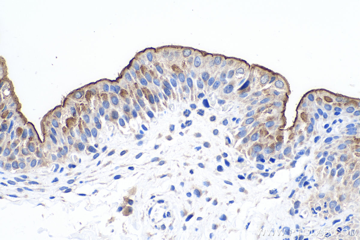 IHC staining of rat bladder using 25275-1-AP