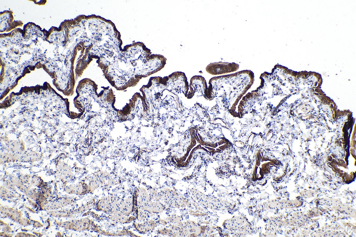 Immunohistochemistry (IHC) staining of mouse bladder tissue using UPK1A Polyclonal antibody (25275-1-AP)