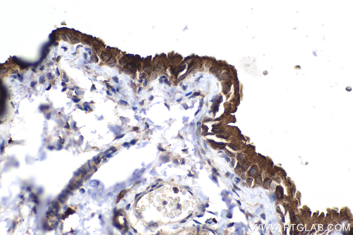 Immunohistochemistry (IHC) staining of mouse bladder tissue using UPK1A Polyclonal antibody (25275-1-AP)