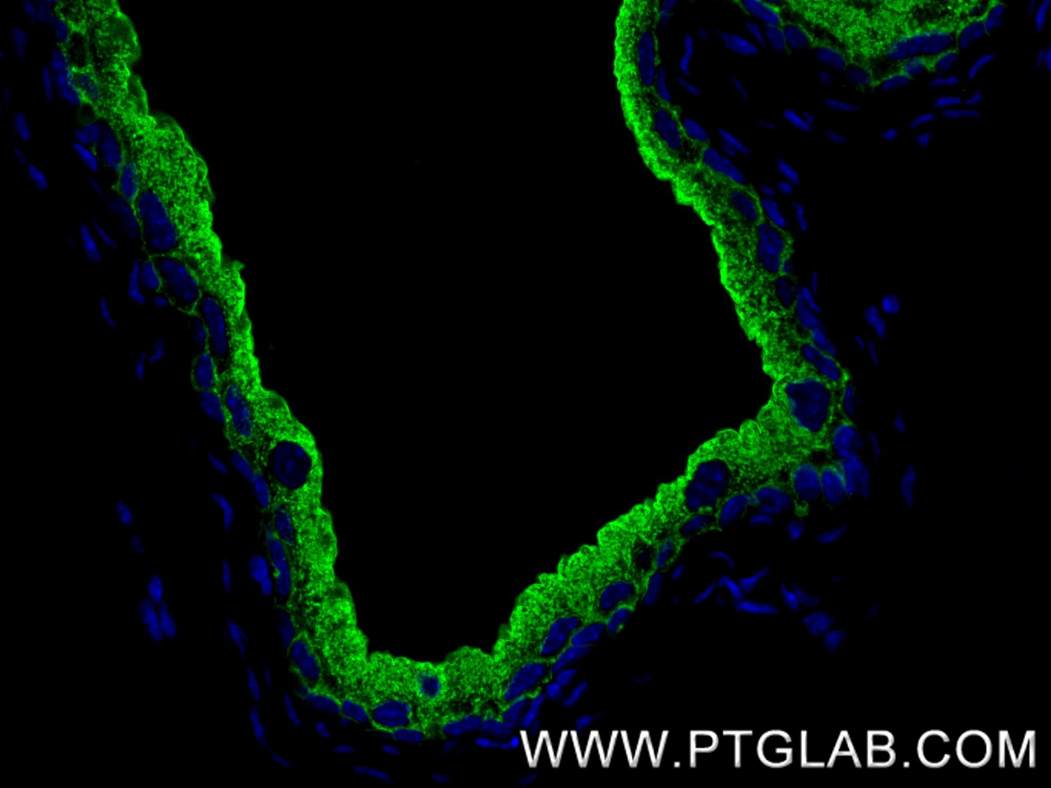 Immunofluorescence (IF) / fluorescent staining of mouse bladder tissue using UPK1A Recombinant monoclonal antibody (86799-1-RR)