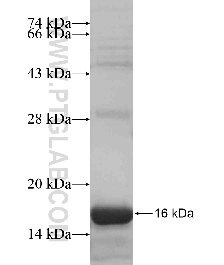 UPK1A fusion protein Ag17356 SDS-PAGE