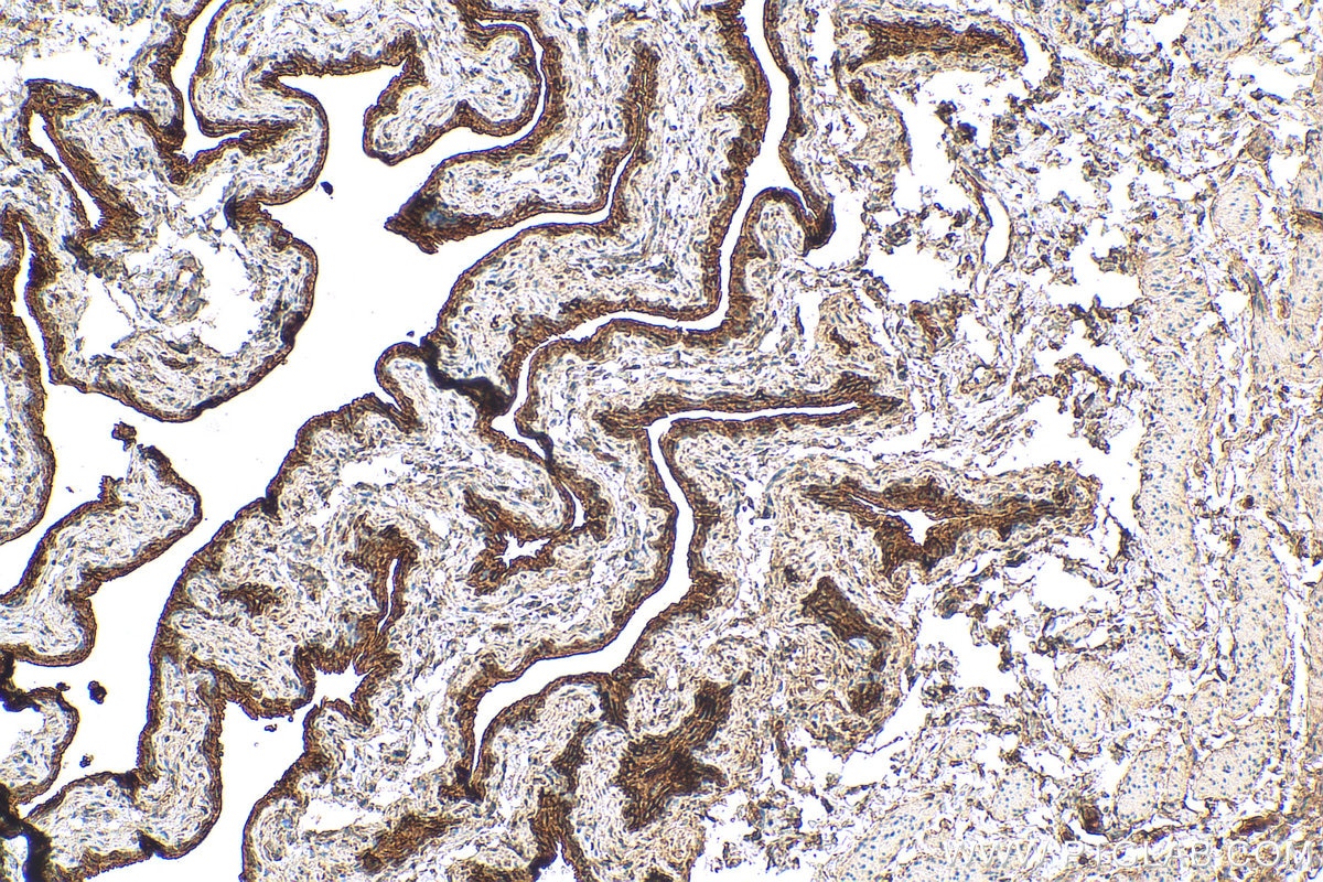 IHC staining of mouse bladder using 26853-1-AP