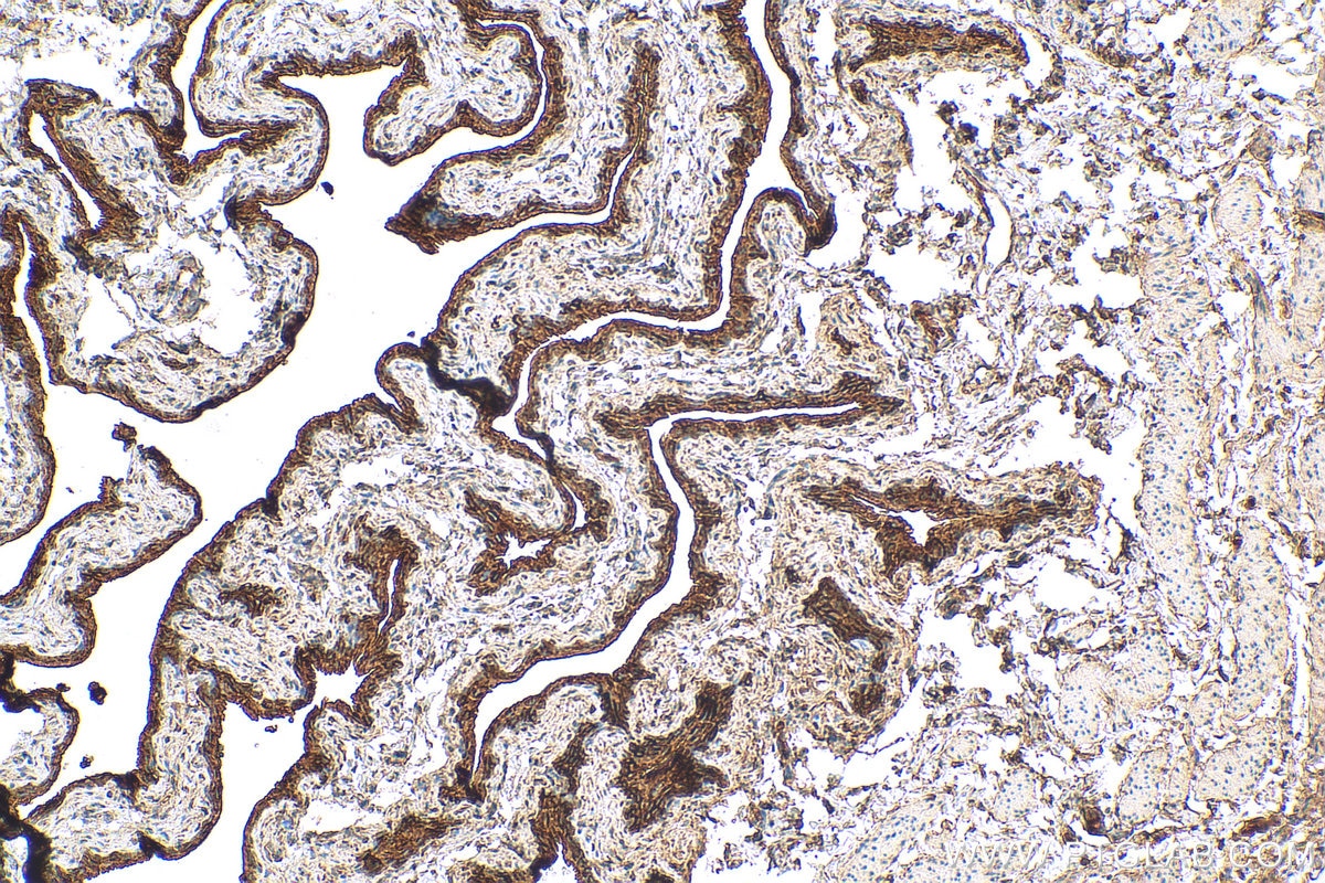 Immunohistochemistry (IHC) staining of mouse bladder tissue using UPK1B Polyclonal antibody (26853-1-AP)