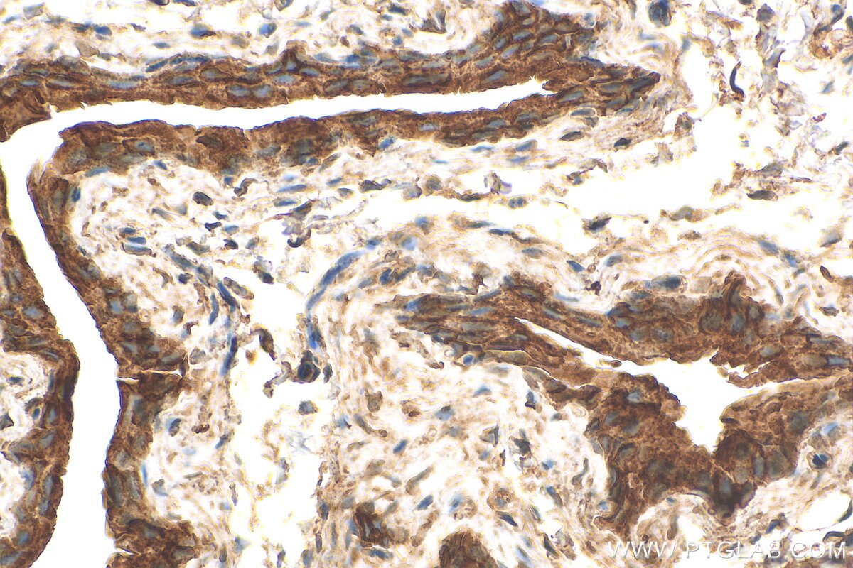 Immunohistochemistry (IHC) staining of mouse bladder tissue using UPK1B Polyclonal antibody (26853-1-AP)