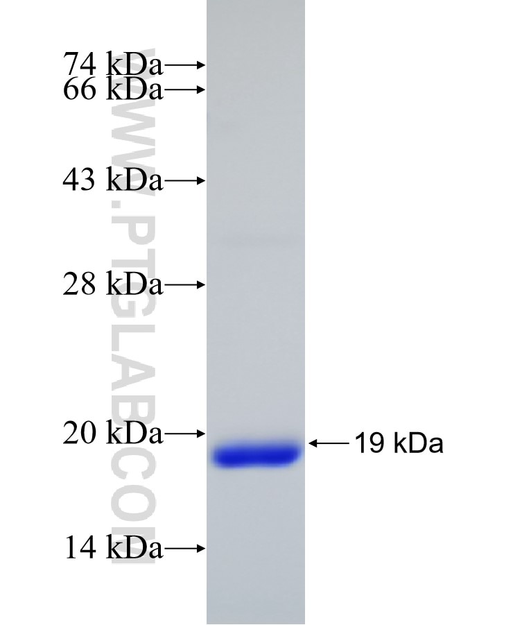 UPK1B fusion protein Ag25471 SDS-PAGE