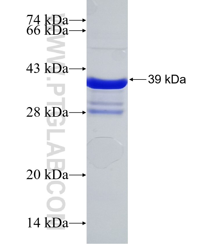 UPK1B fusion protein Ag25492 SDS-PAGE
