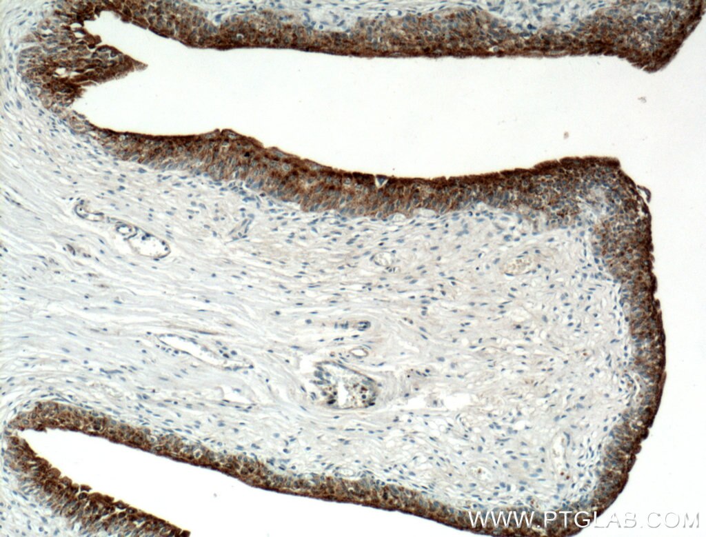 Immunohistochemistry (IHC) staining of human bladder tissue using UPK2 Polyclonal antibody (21149-1-AP)