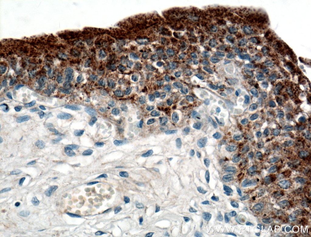 Immunohistochemistry (IHC) staining of human bladder tissue using UPK2 Polyclonal antibody (21149-1-AP)