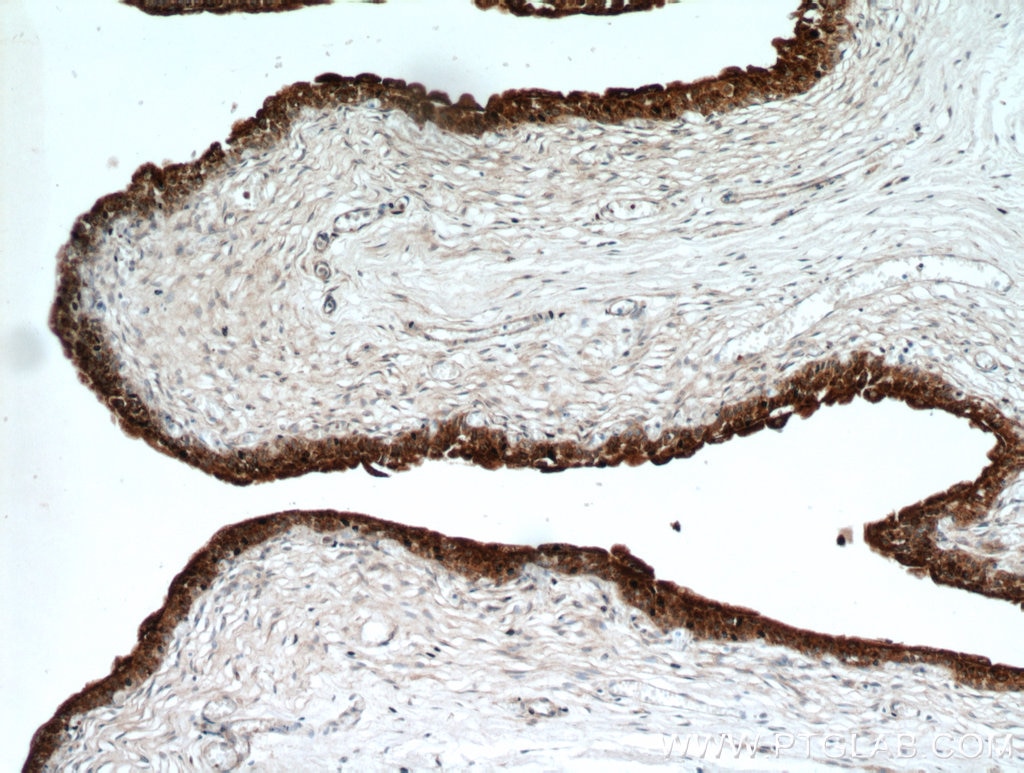Immunohistochemistry (IHC) staining of human bladder tissue using UPK2 Polyclonal antibody (21149-1-AP)