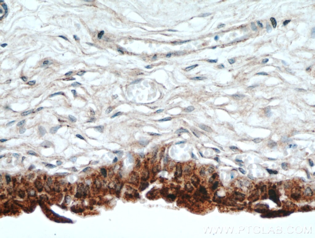 Immunohistochemistry (IHC) staining of human bladder tissue using UPK2 Polyclonal antibody (21149-1-AP)