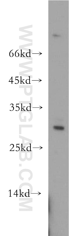 Western Blot (WB) analysis of mouse testis tissue using UPK2 Polyclonal antibody (21149-1-AP)