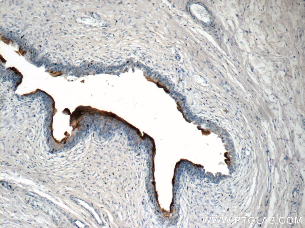 Immunohistochemistry (IHC) staining of human bladder tissue using UPK2-Specific Polyclonal antibody (19733-1-AP)