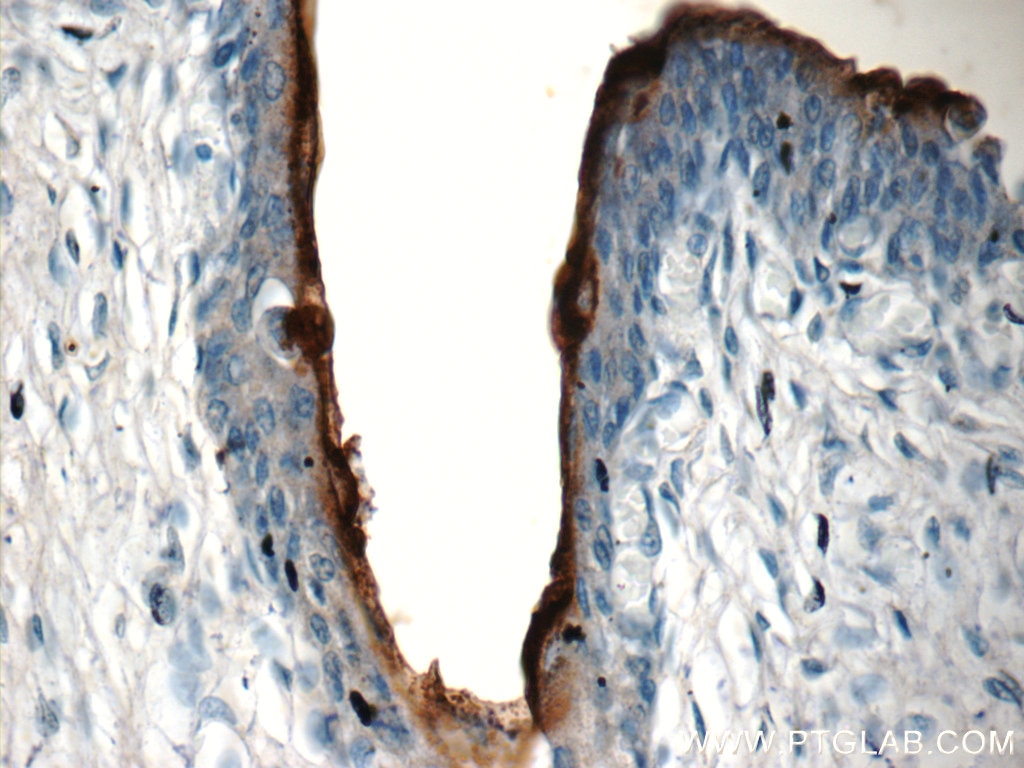 Immunohistochemistry (IHC) staining of human bladder tissue using UPK2-Specific Polyclonal antibody (19733-1-AP)