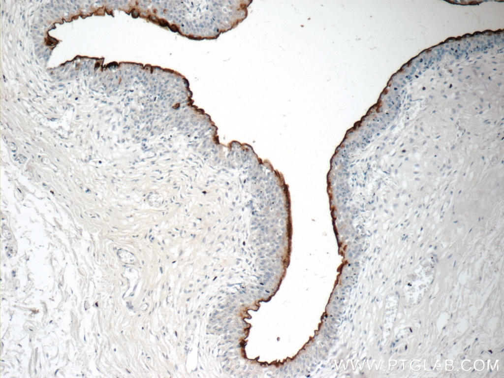 Immunohistochemistry (IHC) staining of human bladder tissue using UPK2-Specific Polyclonal antibody (19733-1-AP)