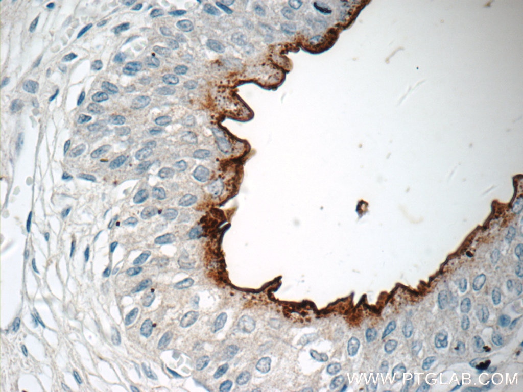 Immunohistochemistry (IHC) staining of human bladder tissue using UPK2-Specific Polyclonal antibody (19733-1-AP)